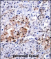 CUGBP1 Antibody (N-term)